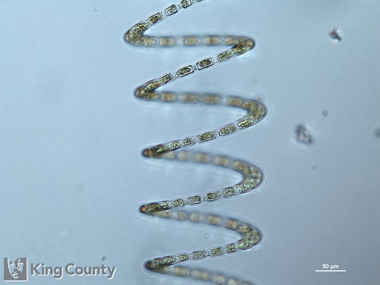 Photo of Eucampia zodiacus